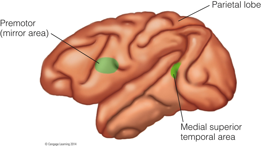 Image:07MST (medial superior temporal area).png