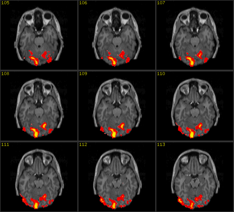 Image:Fmri.h2.gif