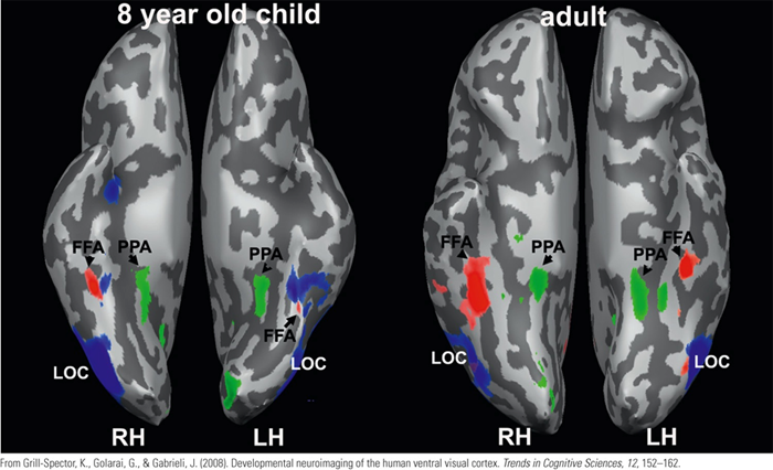 Image:05development inf brain.png