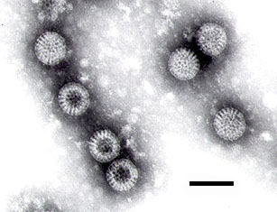 Image:250px-Rotavirus.jpg