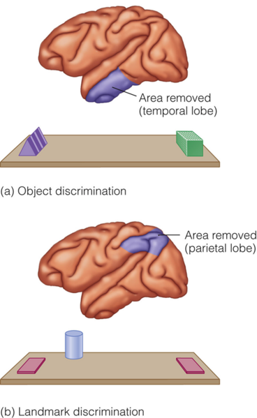 Image:04Brain Ablation.png