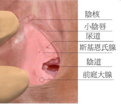 http://upload.wikimedia.org/wikipedia/commons/thumb/7/78/Skenes_gland_zh.jpg/692px-Skenes_gland_zh.jpg